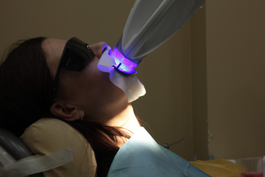 Отбеливание зубов