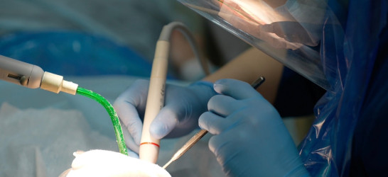 Профессиональная гигиена