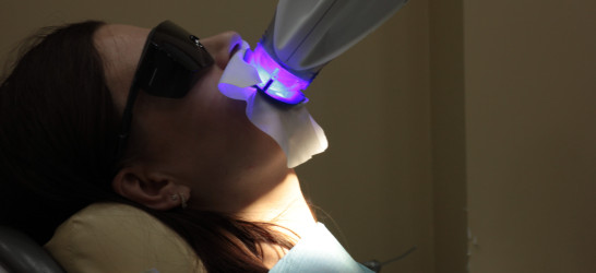 Отбеливание зубов